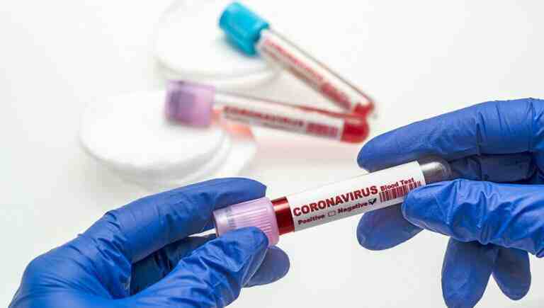 17 Ekim 2020 corona virüs tablosu: 71 can kaybı, bin 723 yeni hasta sayısı